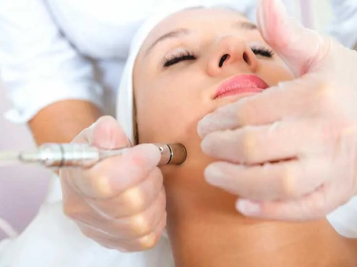 Facial-cleansing - microdermabrasion-device